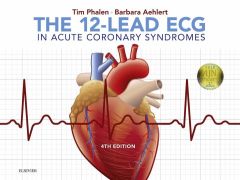 The 12-Lead ECG in Acute Coronary Syndromes