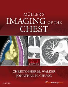 Muller's Imaging of the Chest E-Book