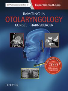 Imaging in Otolaryngology E-Book