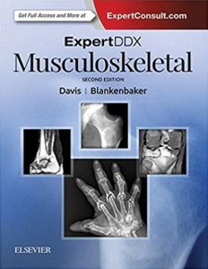 ExpertDDx: Musculoskeletal E-Book