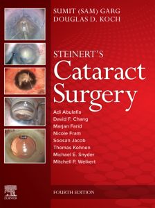 Cataract Surgery