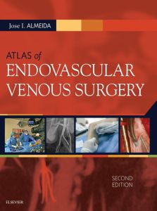 Atlas of Endovascular Venous Surgery E-Book