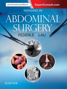 Imaging in Abdominal Surgery E-Book