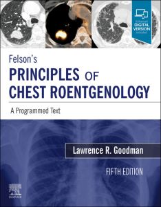 Felson's Principles of Chest Roentgenology Elsevier eBook on VitalSource