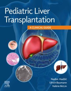 Pediatric Liver Transplantation