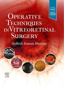 Operative Techniques in Vitreoretinal Surgery E-Book