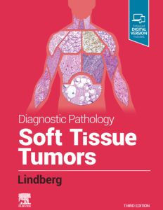 Diagnostic Pathology: Soft Tissue Tumors E-Book