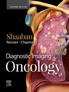 Diagnostic Imaging: Oncology E-Book