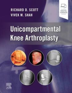 Unicompartmental Knee Arthroplasty, E-Book