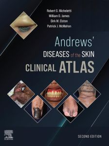 Andrews' Diseases of the Skin Clinical Atlas,E-Book