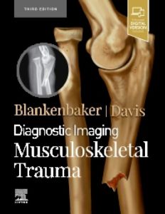 Diagnostic Imaging: Musculoskeletal Trauma,E-Book