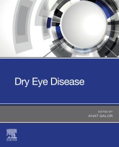 Dry Eye Disease - E-Book