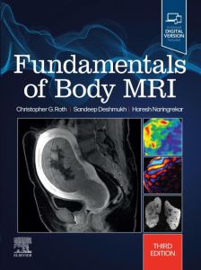 Fundamentals of Body MRI E-Book