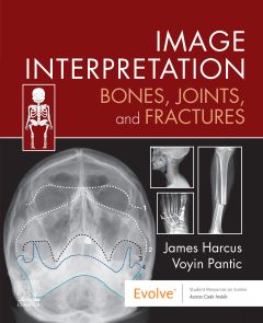 Image Interpretation: Bones, Joints, and Fractures - Elsevier E-Book on VitalSource