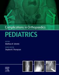 Complications in Orthopaedics: Pediatrics - E-Book