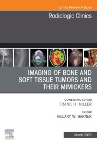 Imaging of Bone and Soft Tissue Tumors and Their Mimickers, An Issue of Radiologic Clinics of North America, E-Book