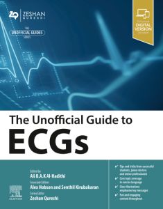 The Unofficial Guide to ECGs - E-Book