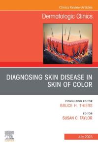 Diagnosing Skin Disease in Skin of Color, An Issue of Dermatologic Clinics, E-Book