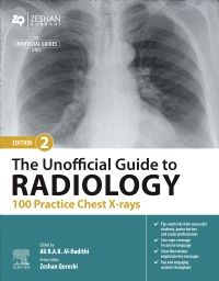 The Unofficial Guide to Radiology: 100 Practice Chest X-rays - E-Book