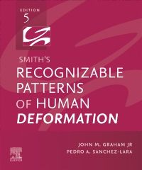 Smith's Recognizable Patterns of Human Deformation E-Book