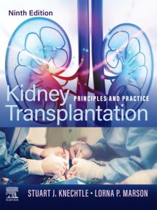 Kidney Transplantation - E-Book