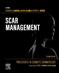 Scar Management - E-BOOK