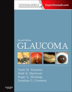 Glaucoma E-Book