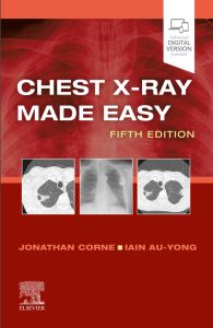 Chest X-Ray Made Easy E-Book