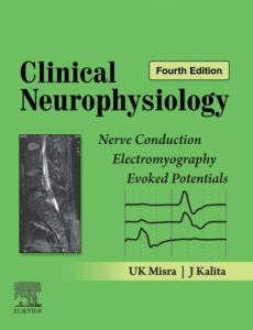 Clinical Neurophysiology