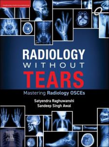 Radiology Without Tears- E-Book