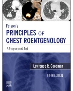 Felson's Principles of Chest Roentgenology E-Book