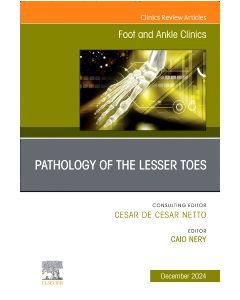 Pathology of the Lesser Toes, An issue of Foot and Ankle Clinics of North America, E-Book